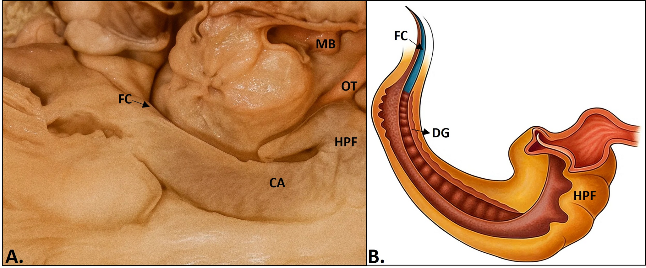 3D Morphometric and Computational Modeling of the Human Fasciola Cinerea: A Hidden Gate of Memory Networks