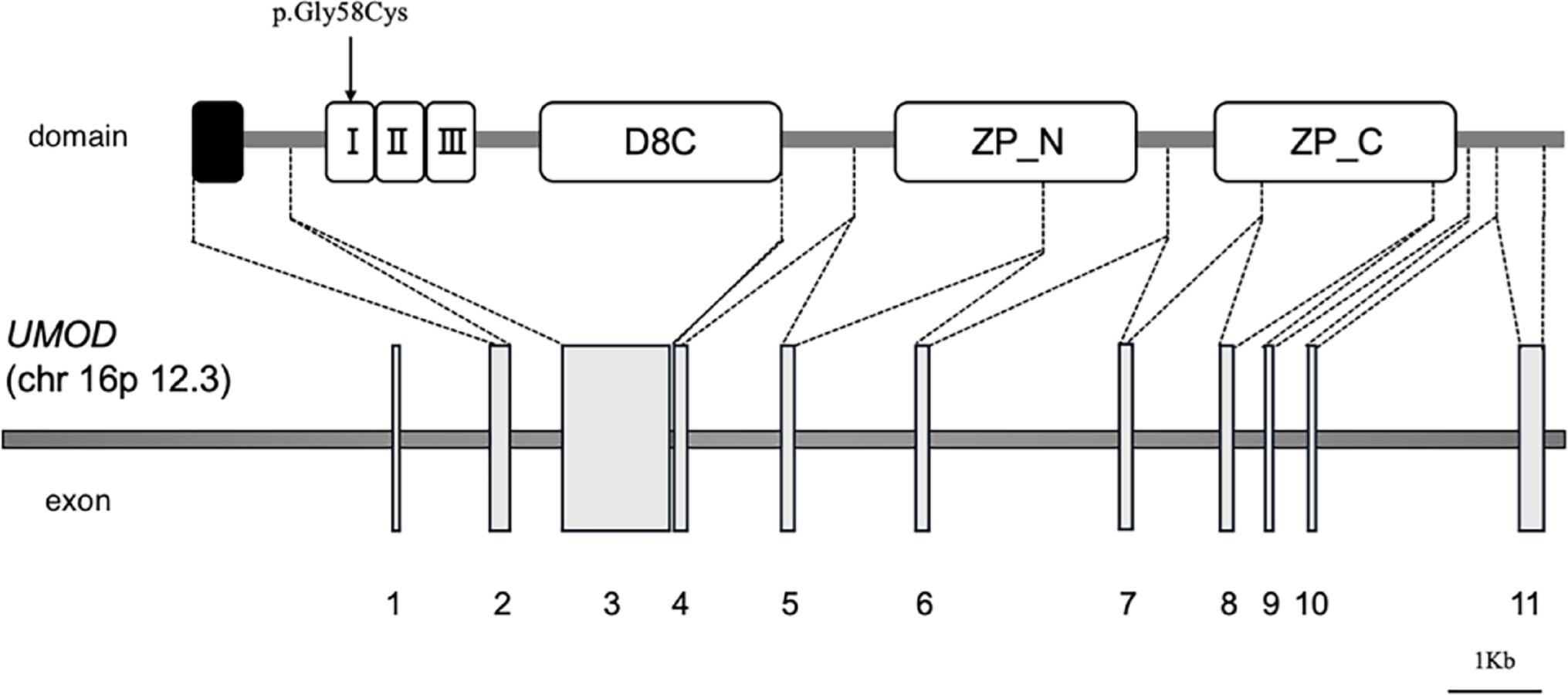 Early-onset kidney failure in a girl with autosomal dominant tubulointerstitial kidney disease due to a de novo  variant