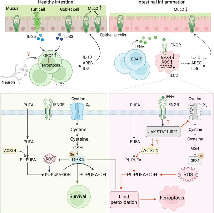 Ferroptosis shapes ILC2 responses in inflammatory bowel disease
