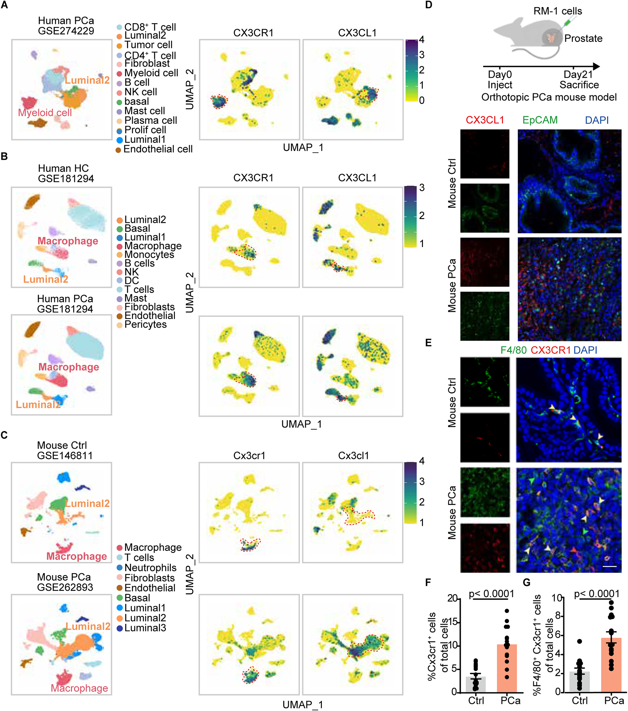 CX3CL1-CX3CR1 signaling orchestrates malignant progression of prostate cancer through luminal progenitor-macrophage crosstalk