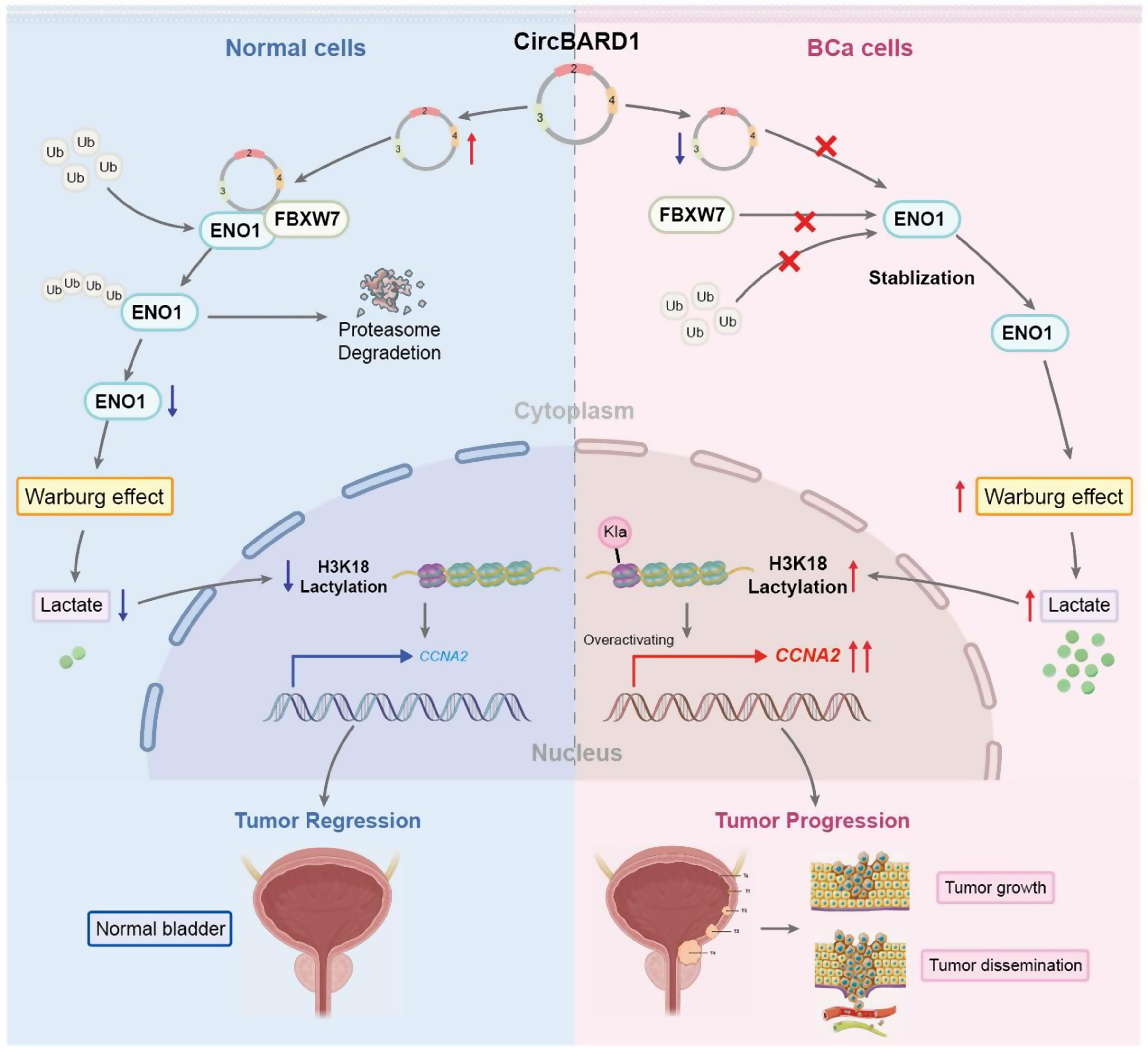 CircBARD1 suppresses tumor progression driven by H3K18 lactylation-CCNA2 axis in human bladder cancer