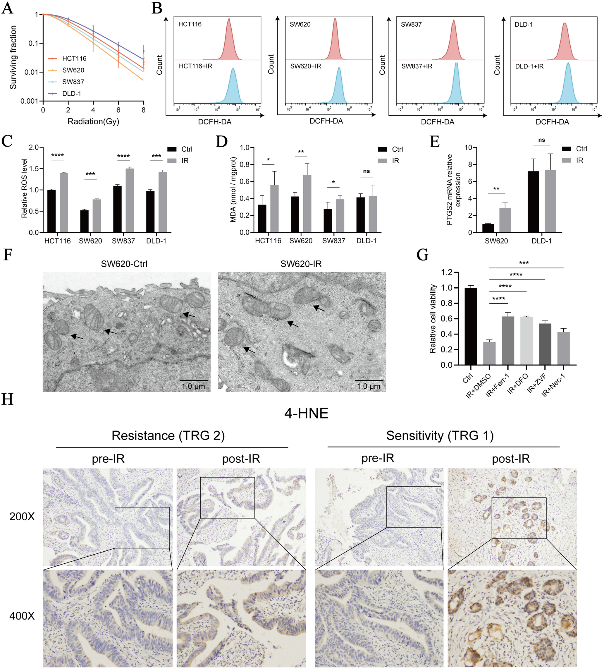 NUAK1 silencing enhances radiotherapy-induced ferroptosis in locally advanced rectal cancer by impairing Nrf2-driven transcription of GPX4