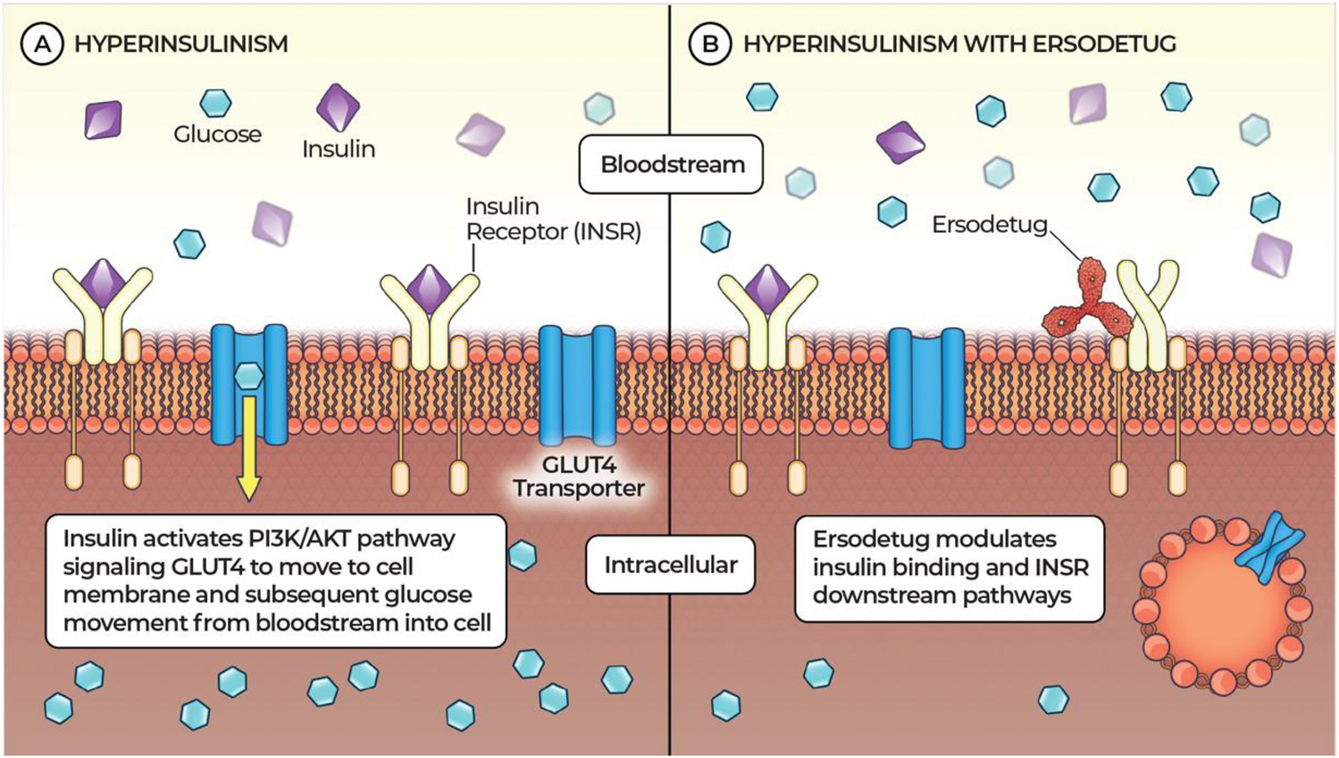 Advances in Pharmacotherapy for Congenital Hyperinsulinism