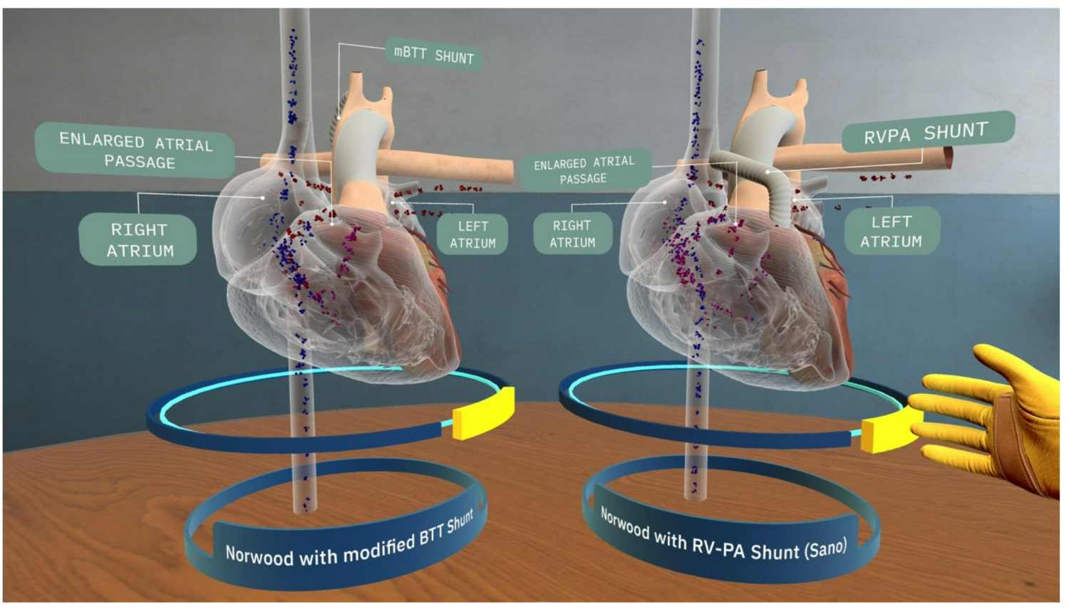 Transforming Pediatric Cardiology Fellowship Education: Multi-center Outcomes of the MACH-3 Virtual Reality Program for HLHS