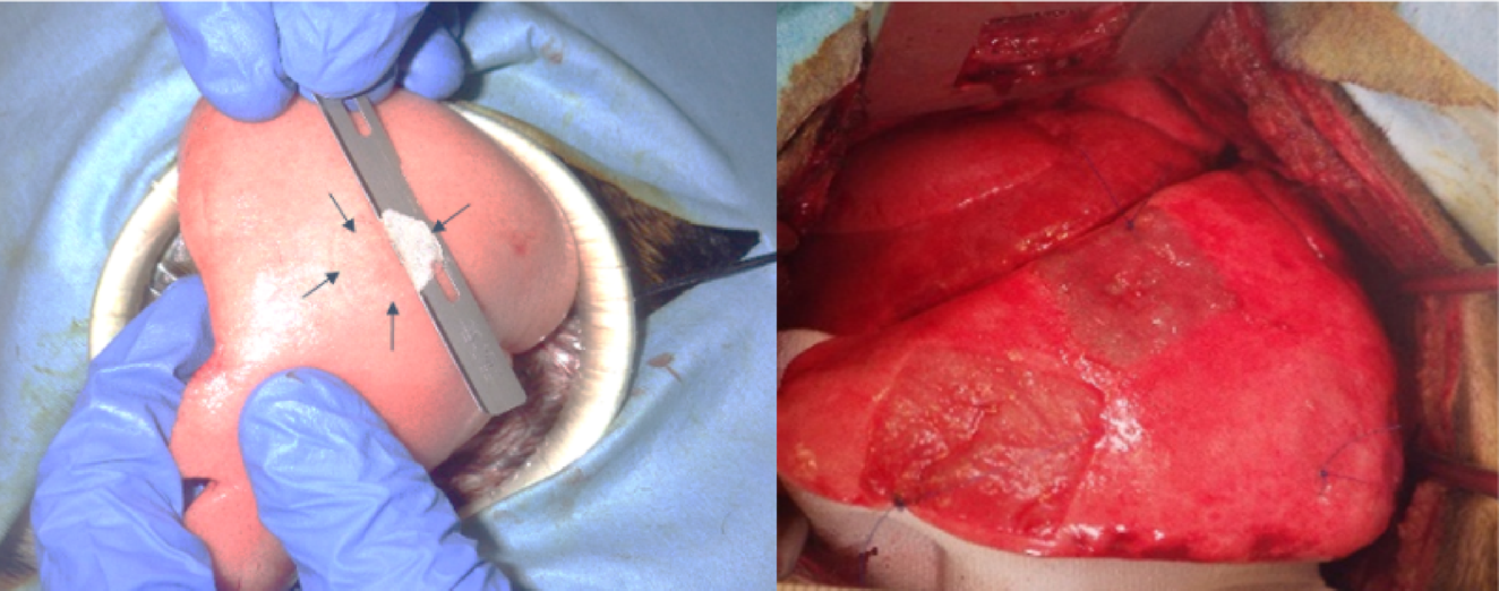 Alteration of PGA sheet composition improves histocompatibility and facilitates pleural repair