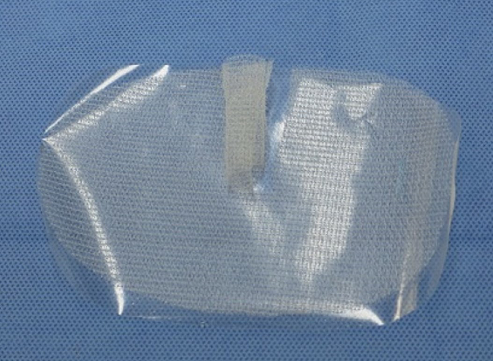 Delivery sheet method for lichtenstein with progrip surgery on inguinal hernia repair