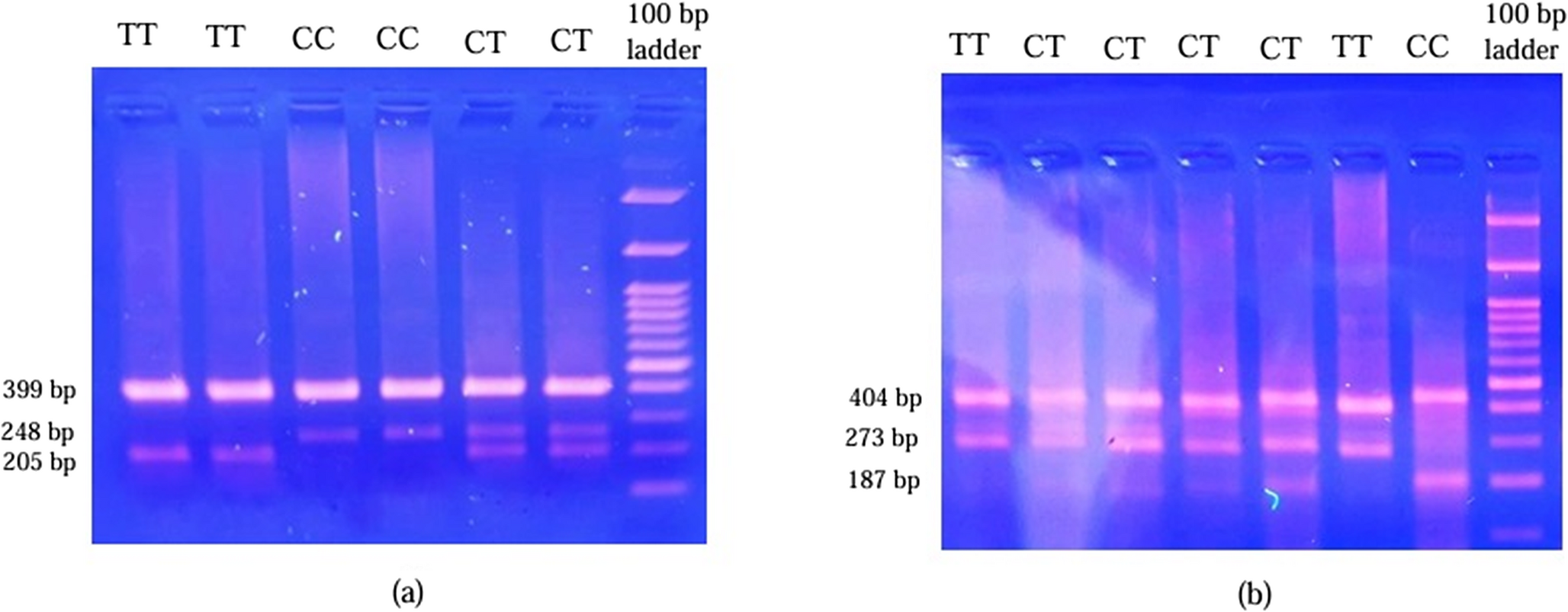 The rs217727 and rs2839698 Variants of the  Gene are Associated with Rheumatoid Arthritis Susceptibility