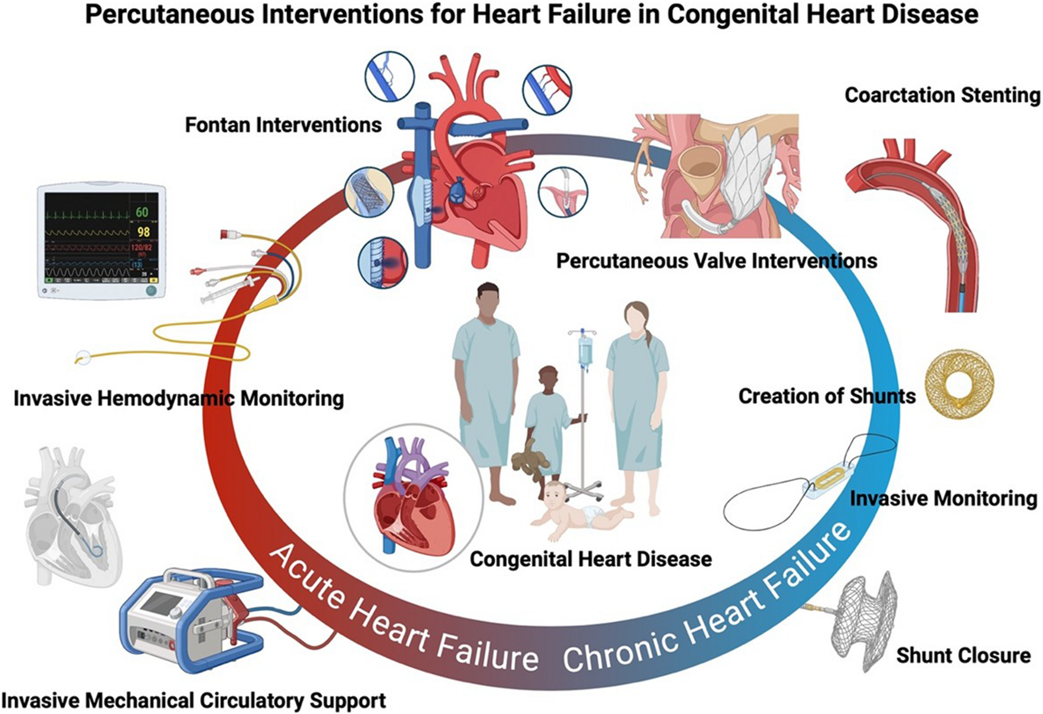 Percutaneous Interventions for Heart Failure in Congenital Heart Disease