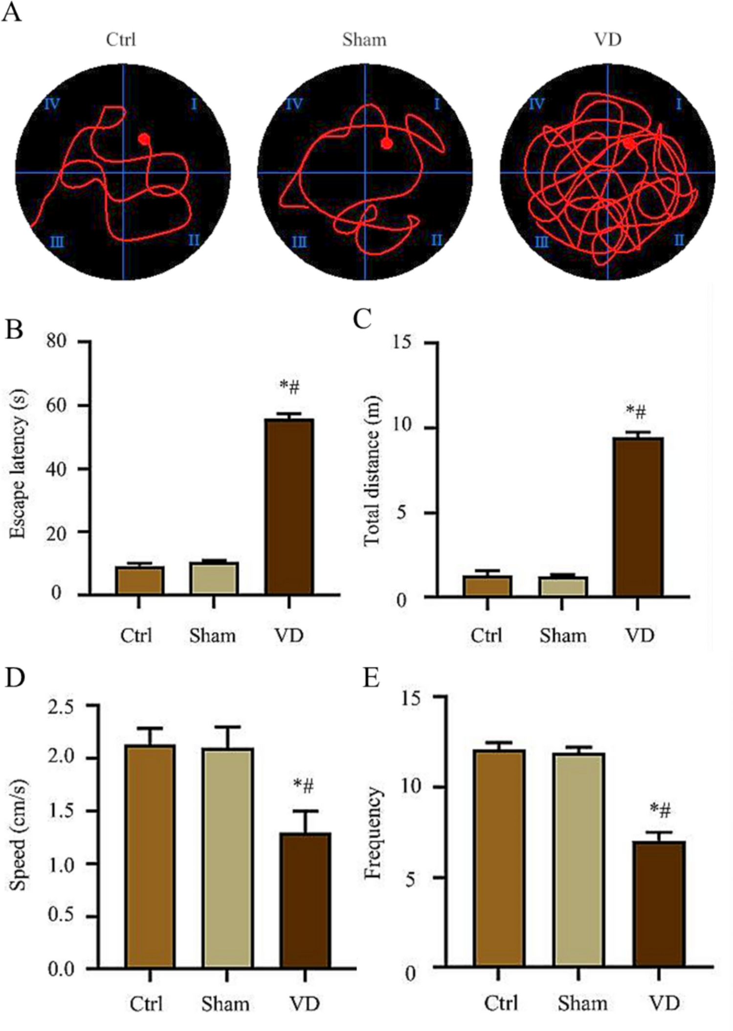 The expression of glial cell-derived neurotrophic factor in the hippocampal tissue of rats with vascular dementia and its correlation with molecular pathways involved in learning and memory impairment