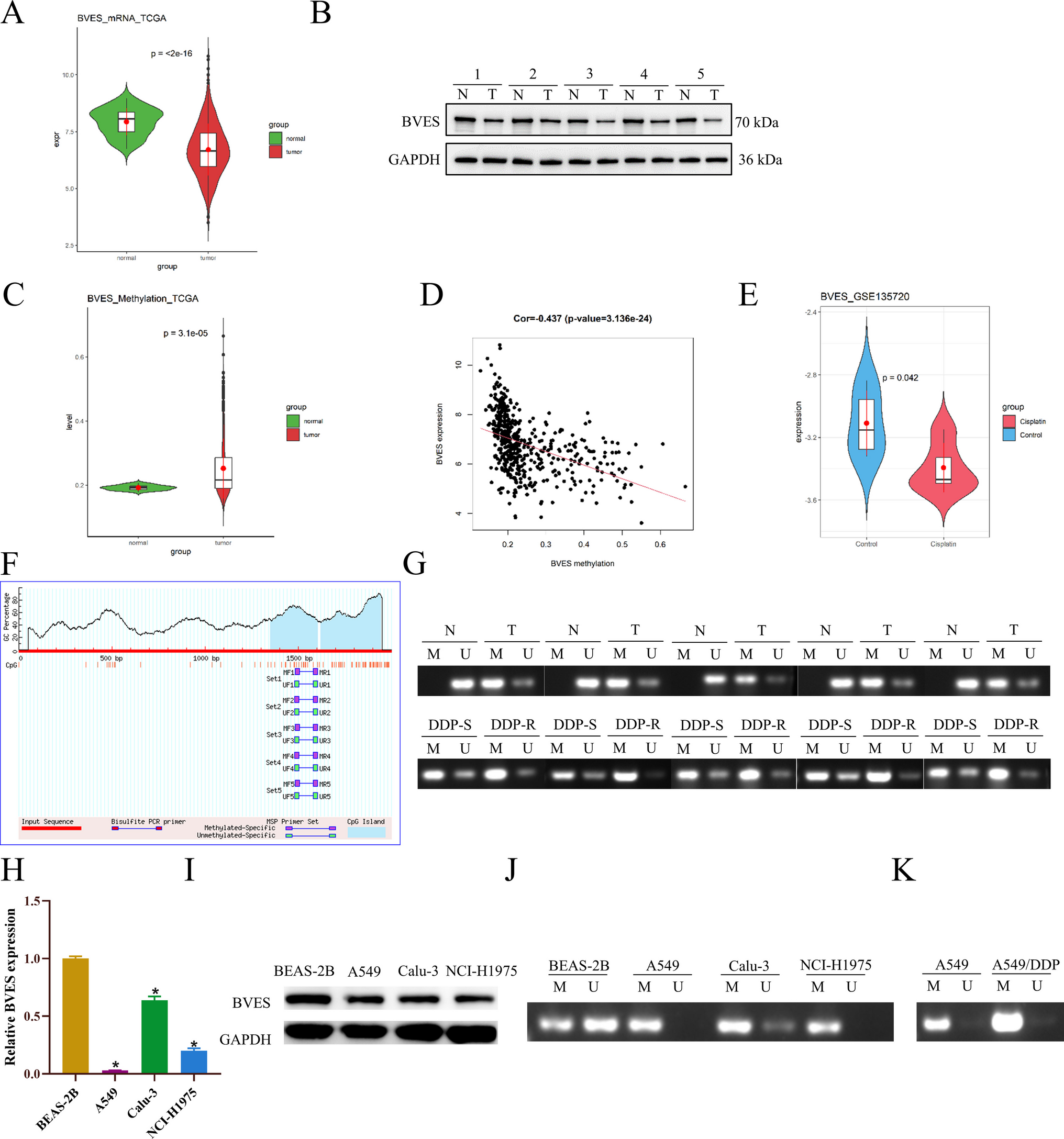 DNA hypermethylation drives BVES-mediated autophagy to promote cisplatin resistance in lung adenocarcinoma