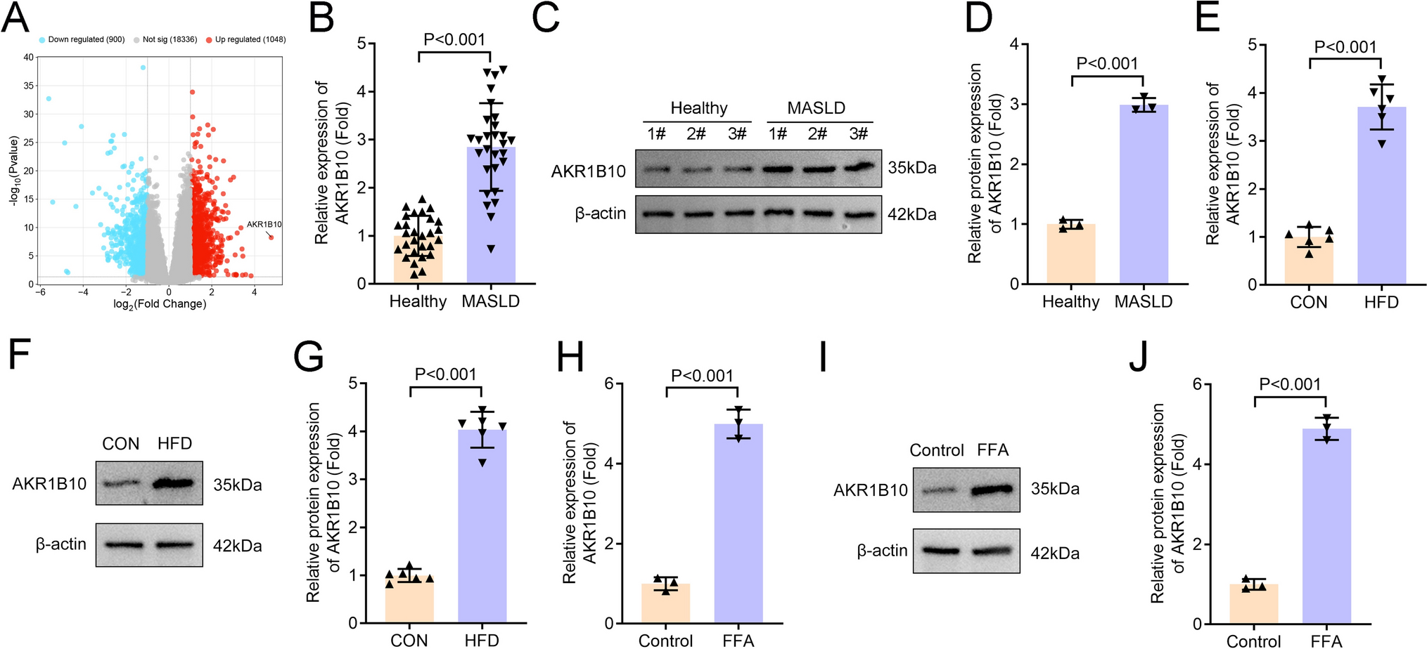 AKR1B10 drives hepatic steatosis and inflammation in metabolic dysfunction-associated steatotic liver disease via PI3K/AKT-mediated autophagy suppression
