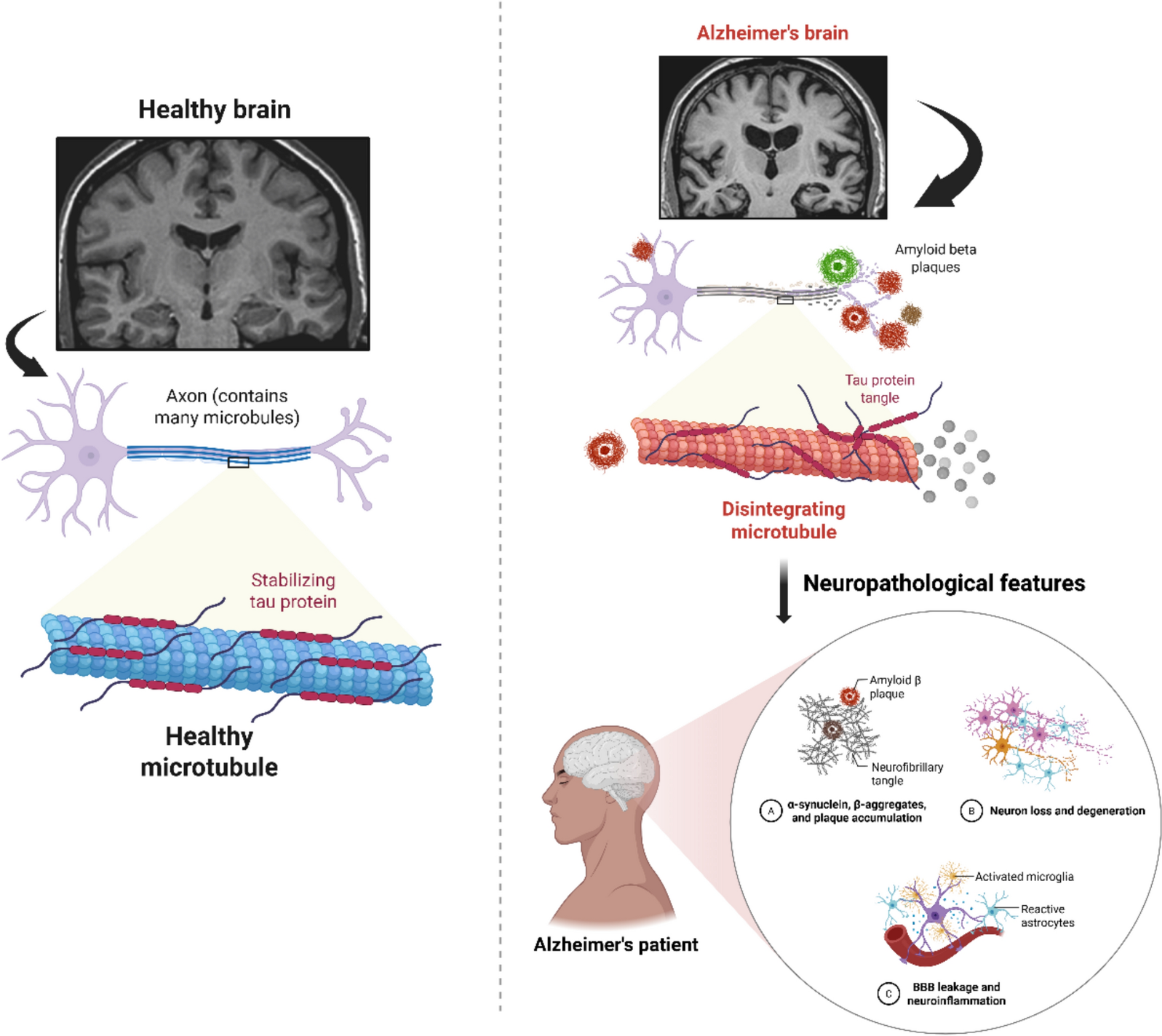 Advancing diagnostic biomarkers in Alzheimer’s disease: interdisciplinary innovations and technological frontiers