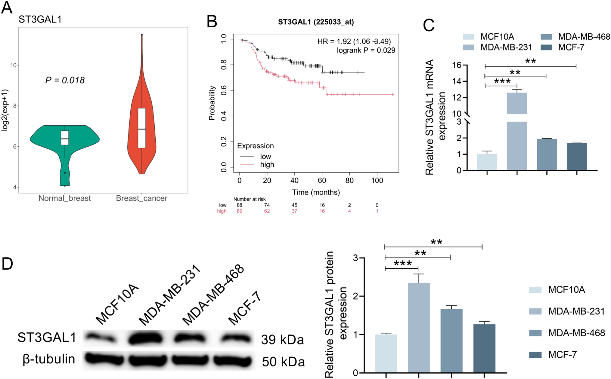 The sialyltransferase ST3GAL1 mediates MUCL1 sialylation to exacerbate breast cancer progression