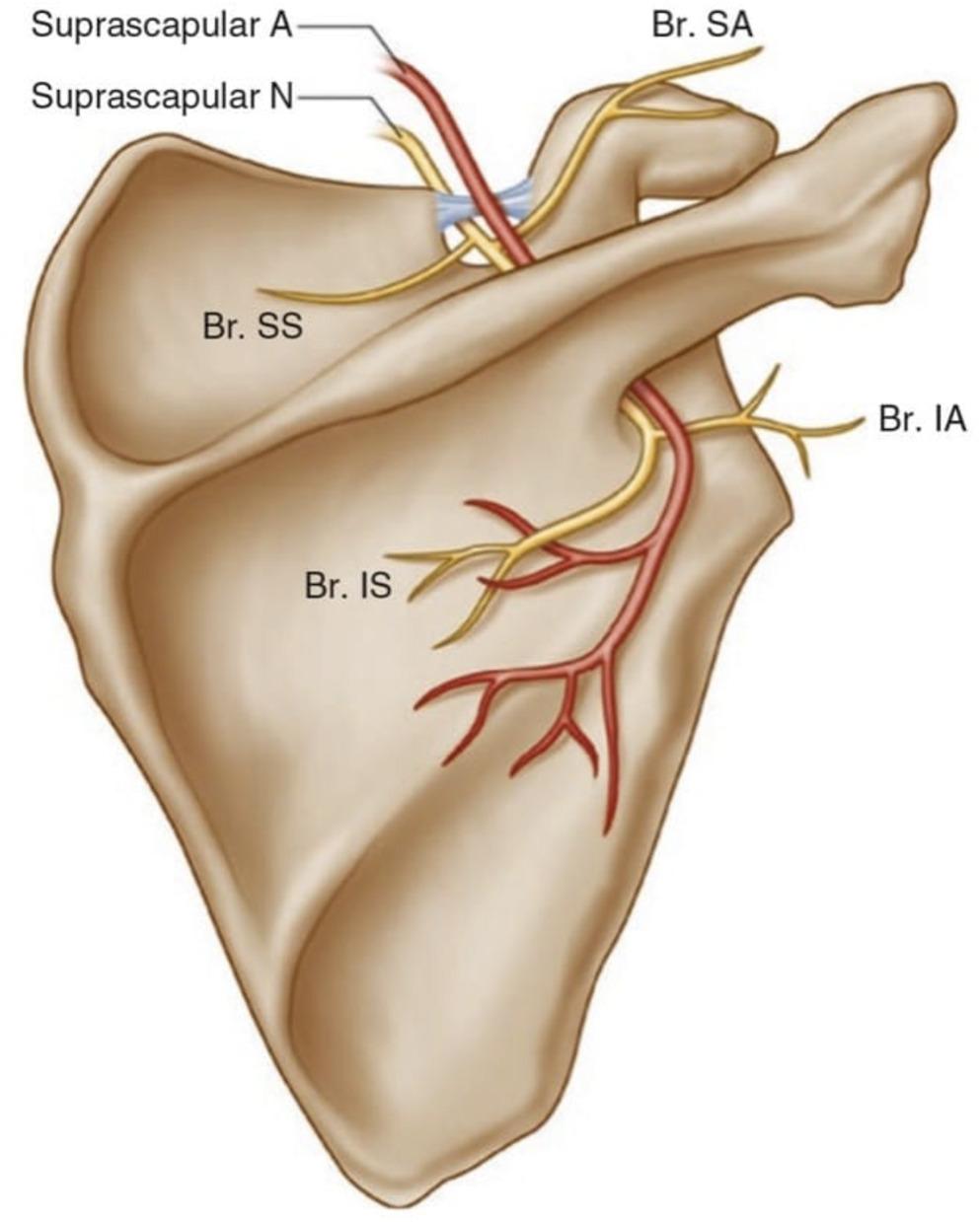 Ultrasound Guided Radiofrequency Ablation of Suprascapular Nerve for Shoulder Pain: A Novel Technique Description