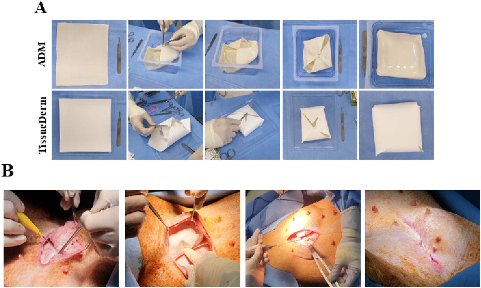 Correction: A 3D Printed Poly(ε-caprolactone)-Collagen Hybrid Mesh (TissueDerm) for Breast Reconstruction after Mastectomy in a Pig Model