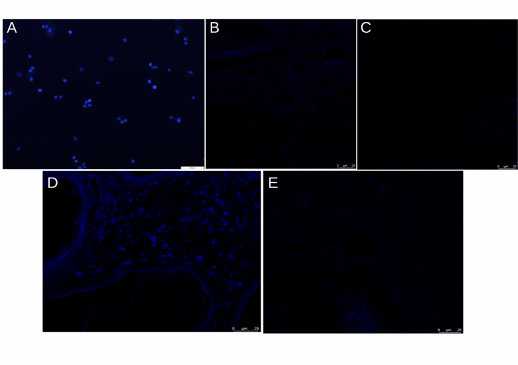 Effects of human umbilical cord derived mesenchymal stem cells transplantation on ovarian function in rats with ovarian hyperstimulation syndrome