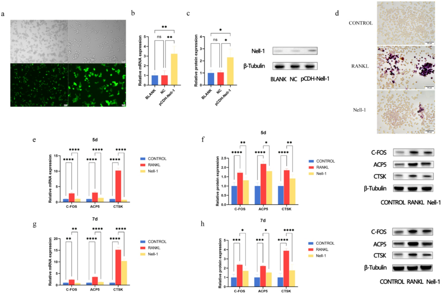 Nell-1 inhibits osteoclast differentiation and bone resorption in apical periodontitis