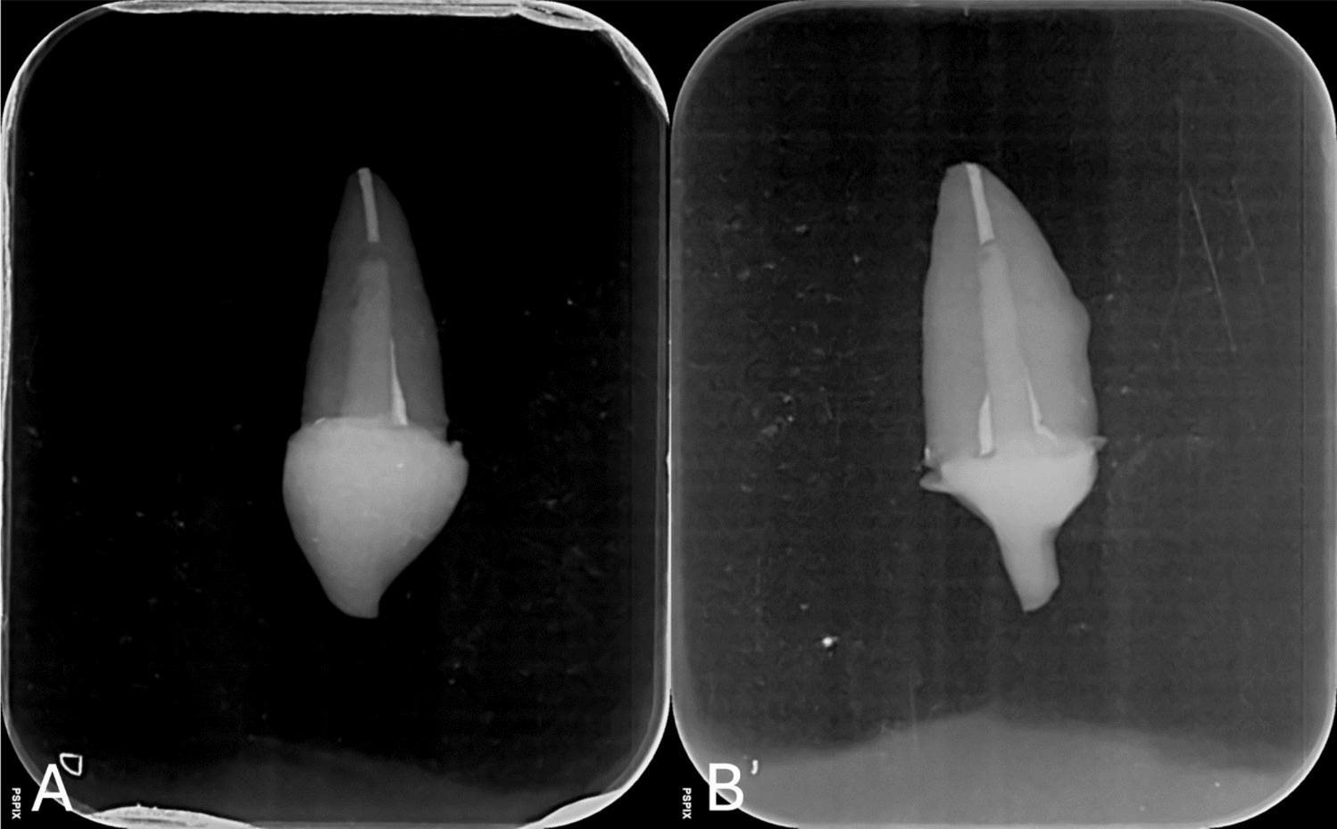 Effect of root canal molding method on bond strength and cement thickness of milled fiber posts
