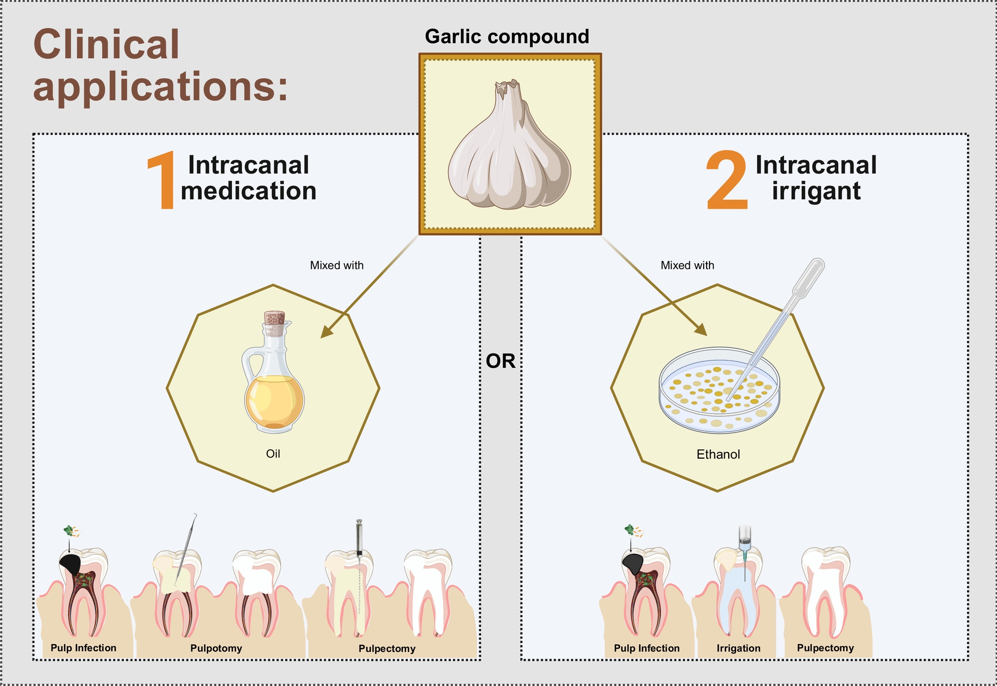 Garlic as a novel therapeutic agent for the management of pulp infections: a systematic review