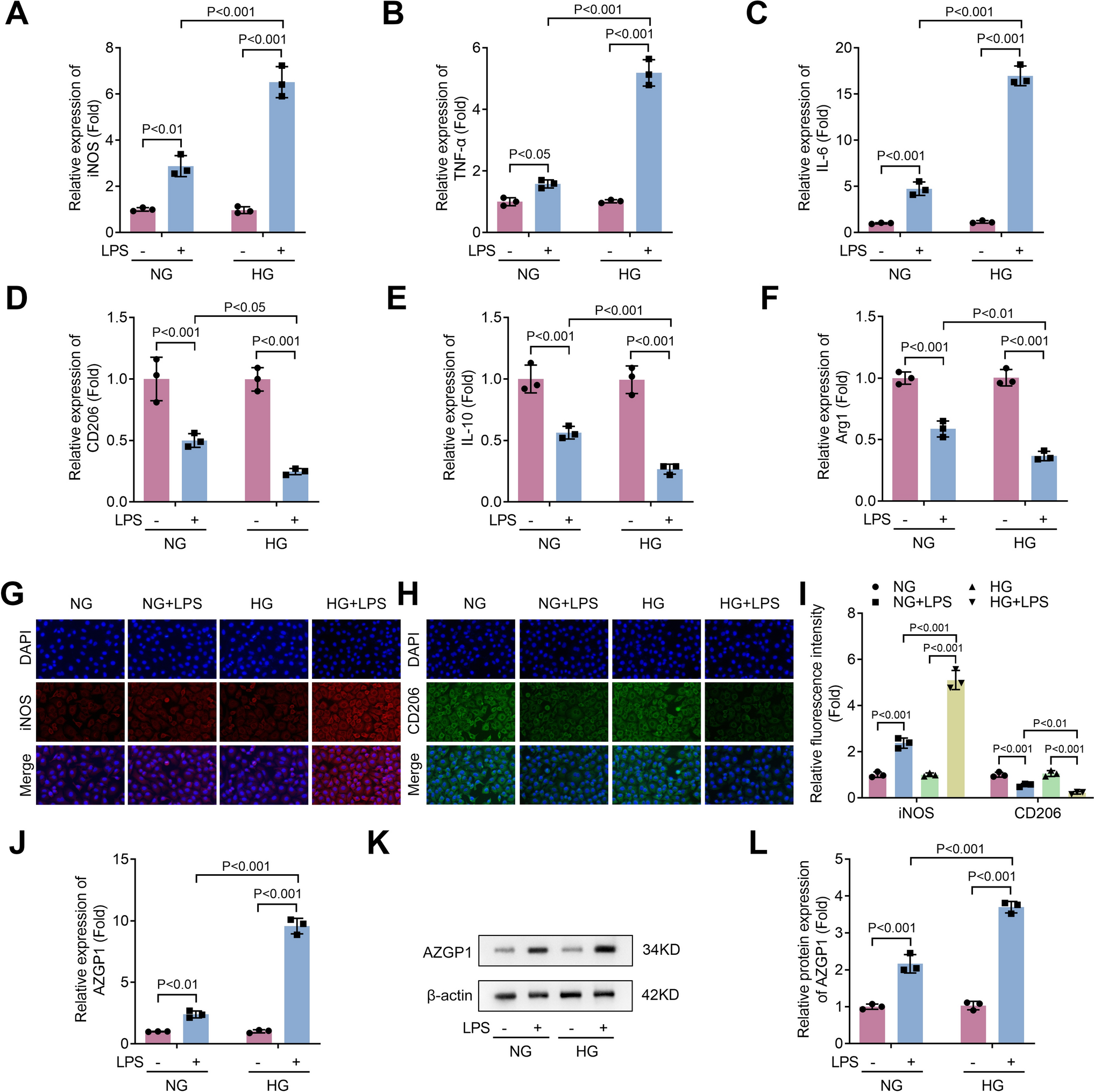 O-GlcNAcylation of AZGP1 regulates M1/M2 macrophage polarization in diabetic periodontitis