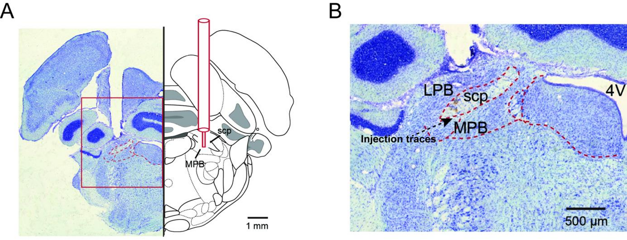 Adenosine A1 receptor in the medial parabrachial nucleus modulates sleep-wake regulation and homeostatic processes