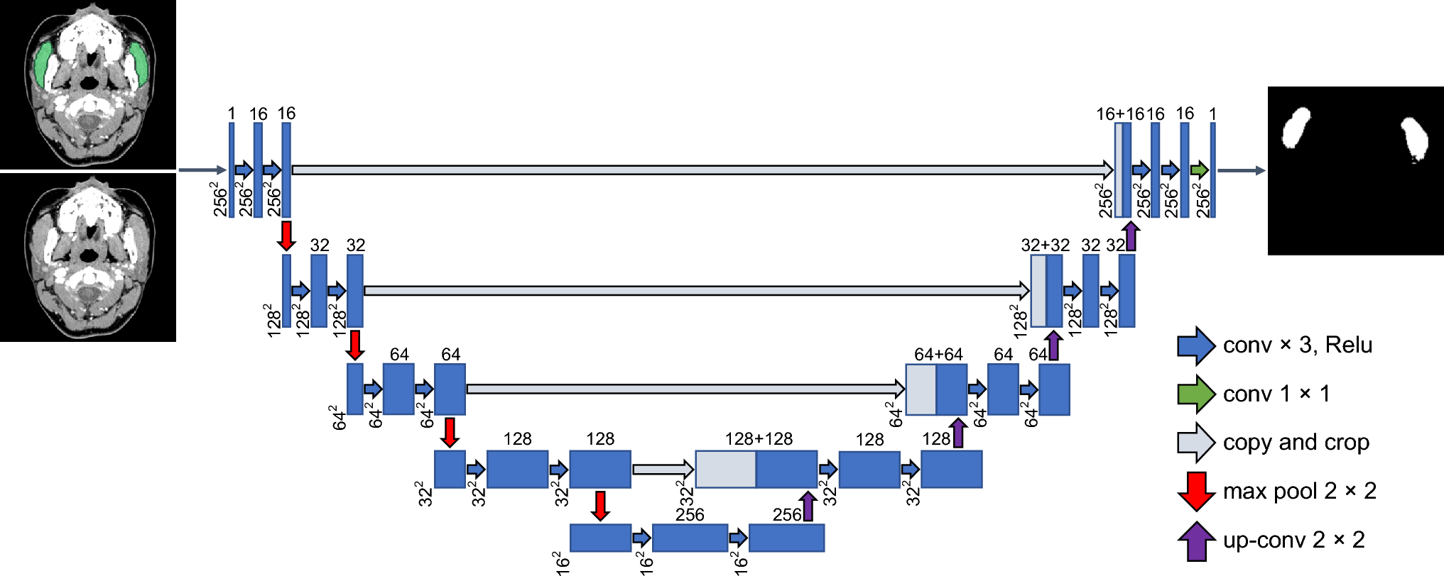 Deep learning-based automated masseter muscle area on routine CT stratifies survival in oral cancer
