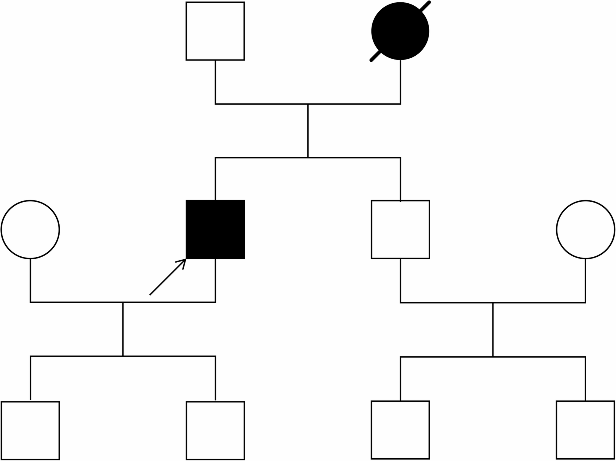Slowly progressive amyotrophic lateral sclerosis associated with a rare SOD1 Pro67Arg mutation: a case report