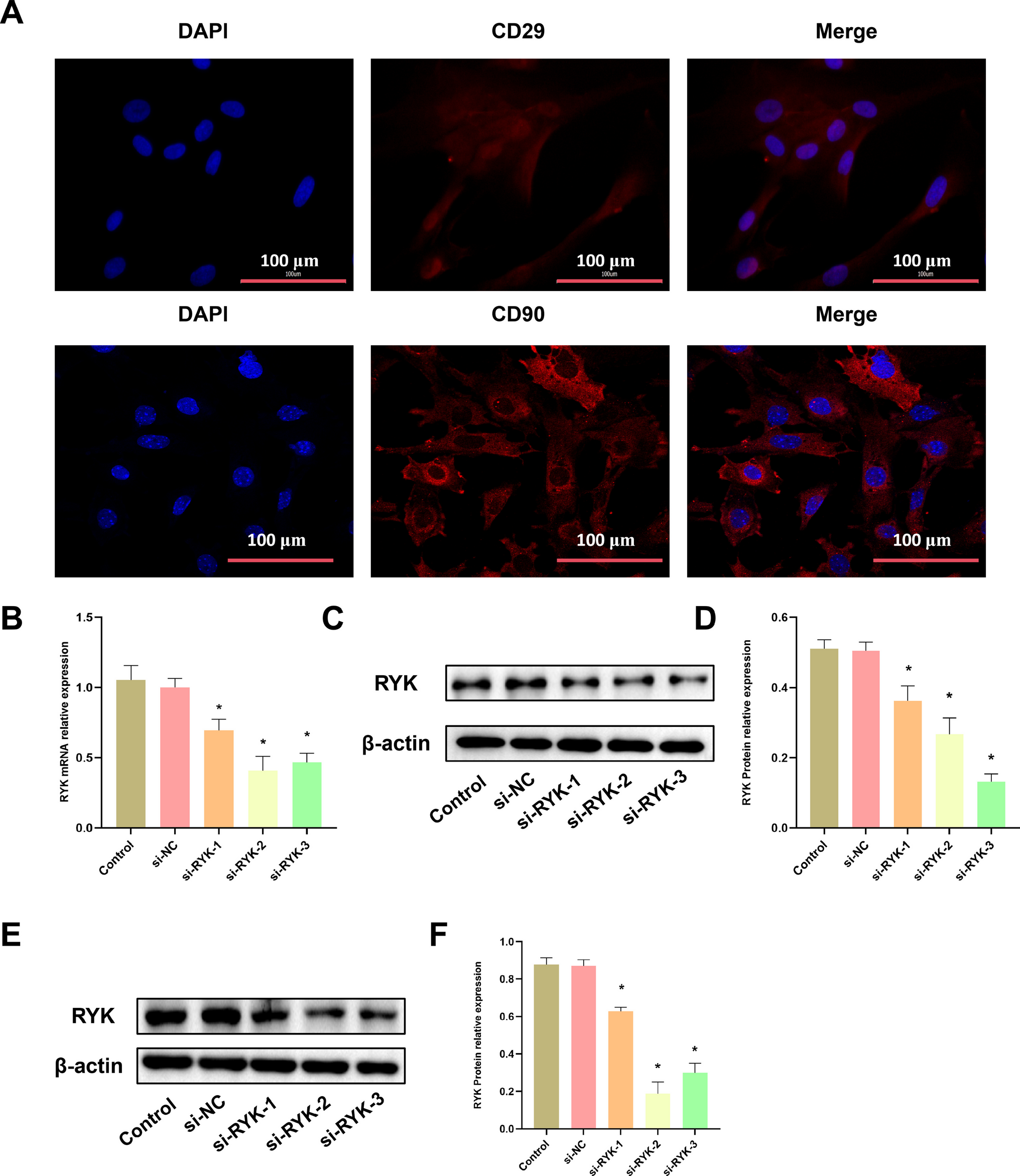 RYK silencing-modified bone marrow-derived mesenchymal stem cells suppress gastric cancer progression