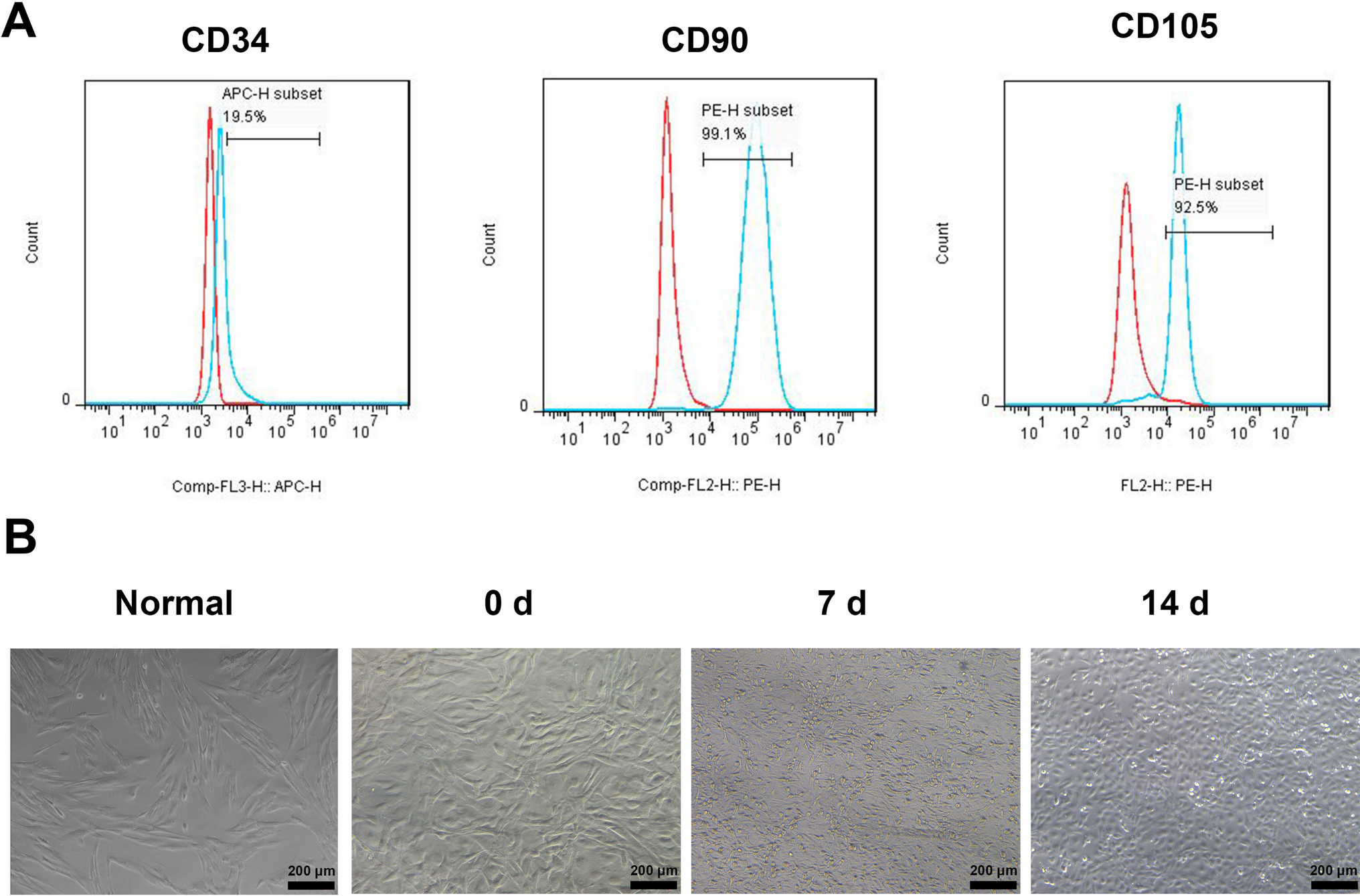 miR-3614-5p prevents endothelial differentiation and angiogenesis in human exfoliated deciduous teeth by targeting lysophosphatidic acid receptor 2
