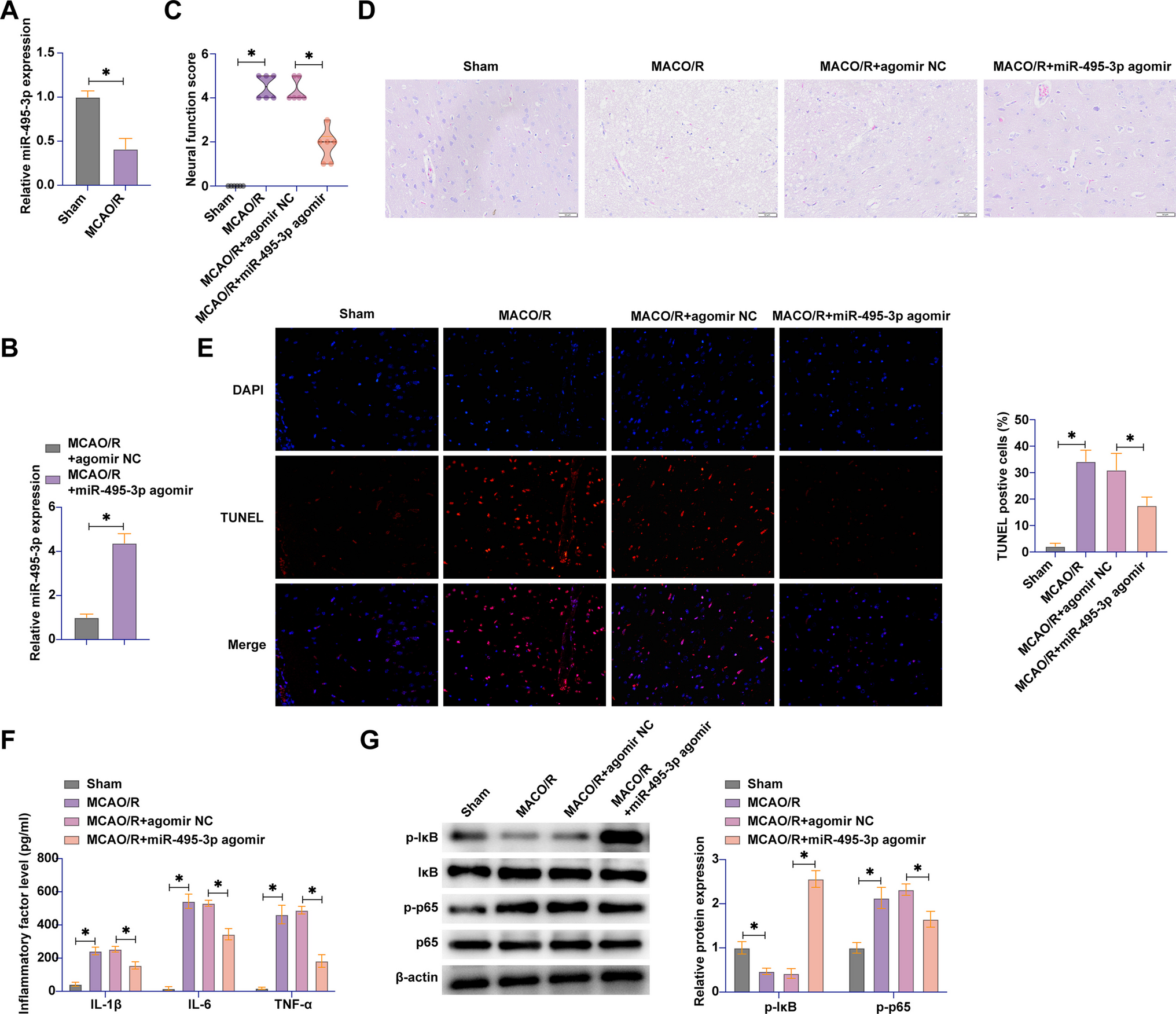 miR-495-3p attenuates cerebral ischemia-reperfusion-induced neuronal inflammation and apoptosis by targeting CCL2 expression