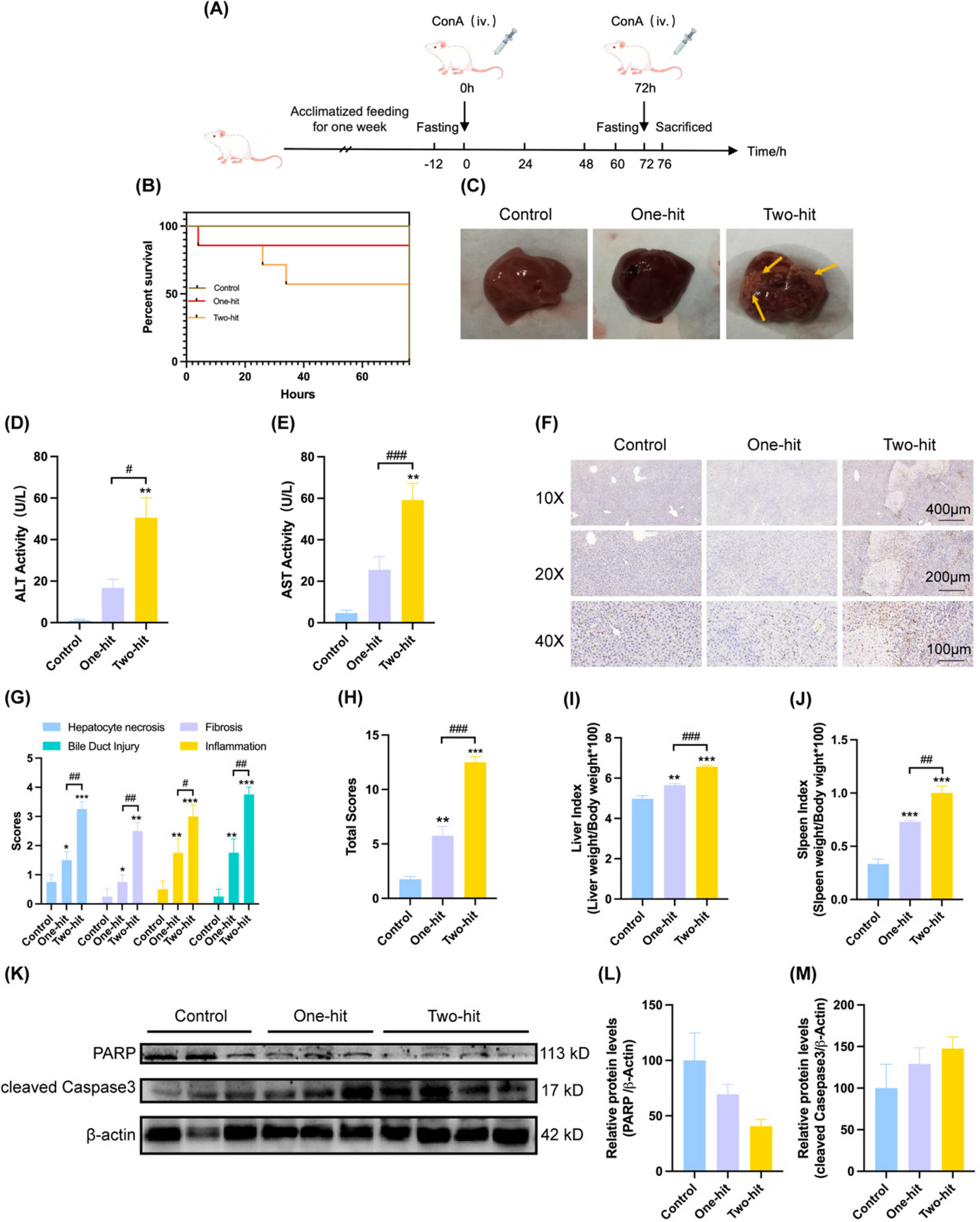 Comparative pathophysiological modeling: the advantage of “two-hit” over “one-hit” in acute liver failure studies