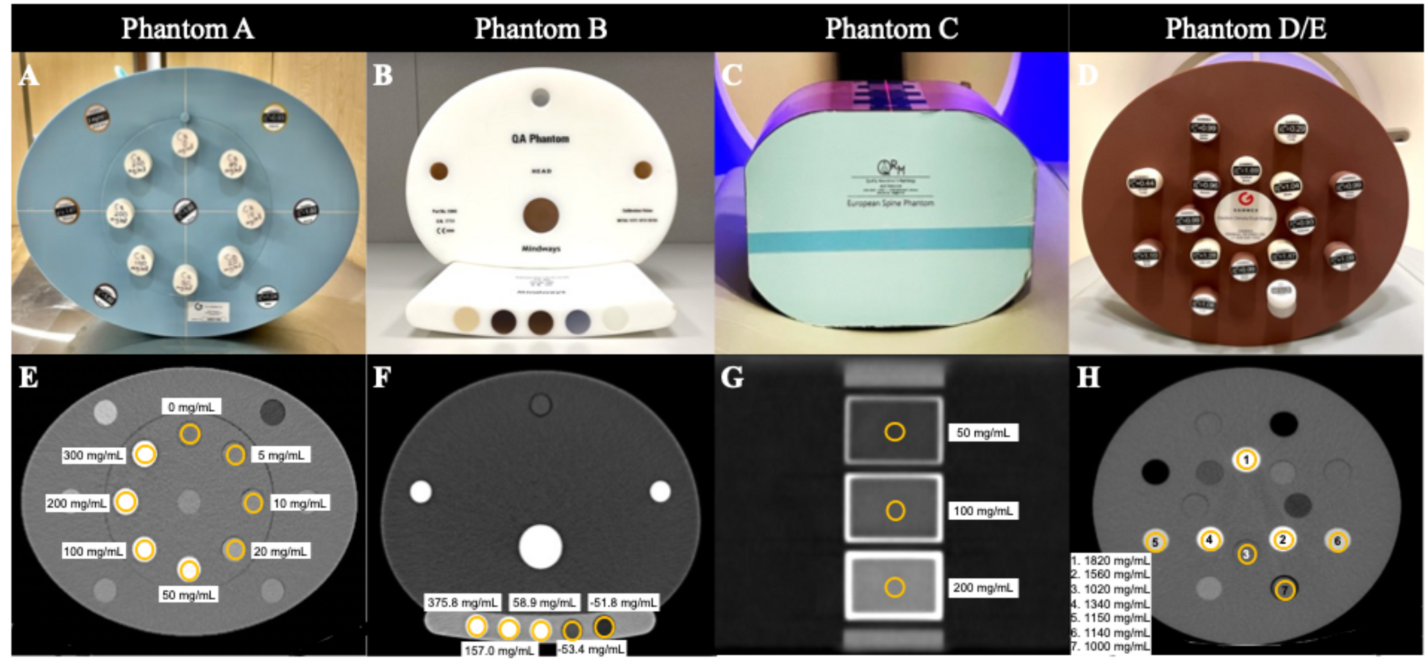 Quality control of opportunistic multi-energy CT bone mineral density quantification