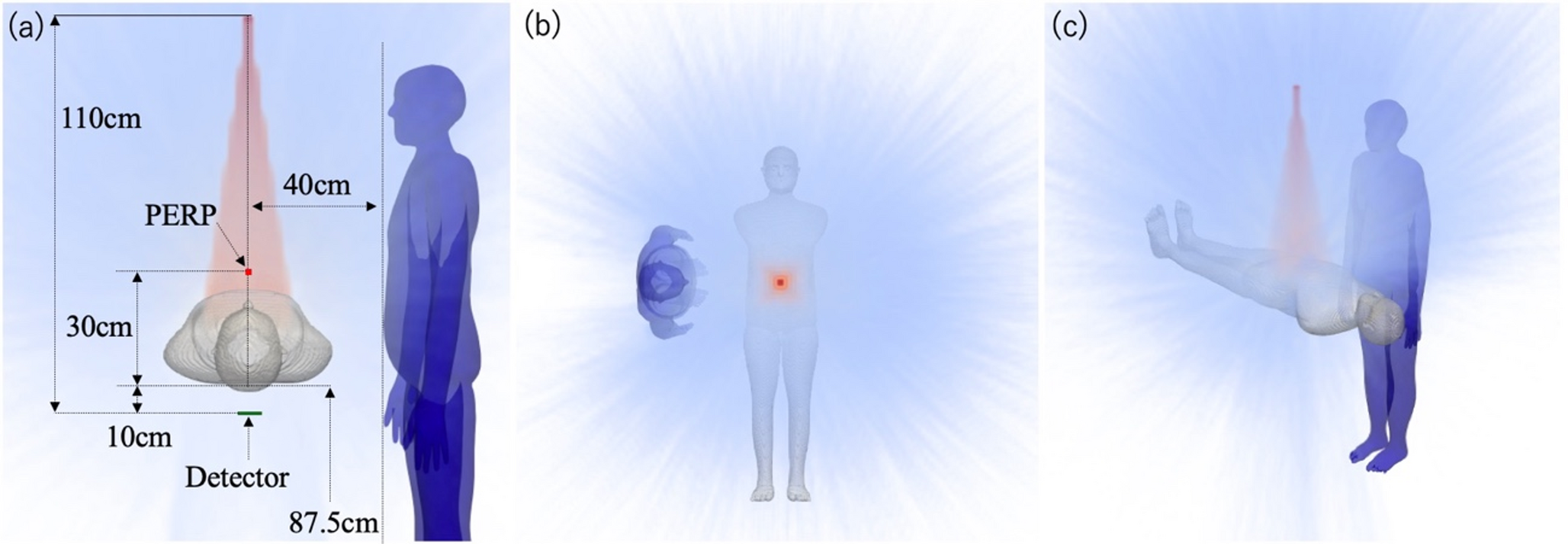 Impact of added filtration and field size on operator eye lens exposure in over-table fluoroscopy: a Monte Carlo simulation study