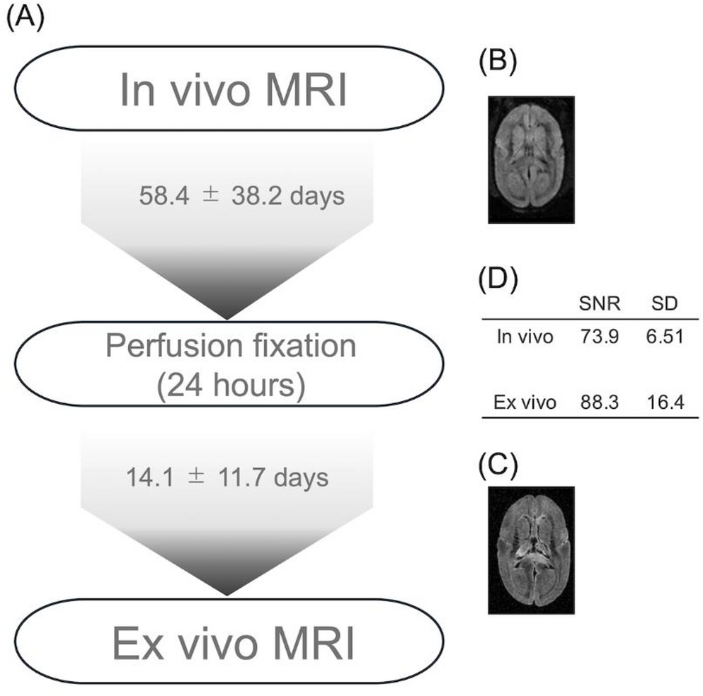 Effects of perfusion fixation on whole-brain structural connectivity in marmoset: a diffusion MRI analysis