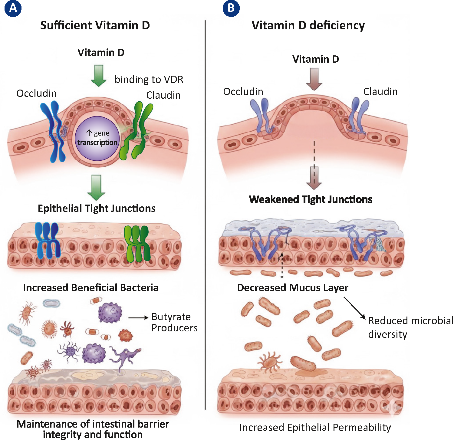 Vitamin D in Gut and Systemic Immune Tolerance and in Infections’ Risk: An International Evidence-Based Consensus Statement