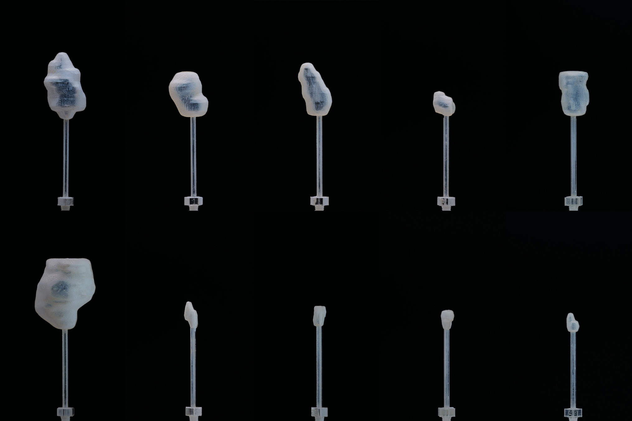 Estimation and Correction of the Partial Volume Effect Using Personalized Phantoms of Lymph Node Metastases in Lutetium 177 SPECT/CT Dosimetry