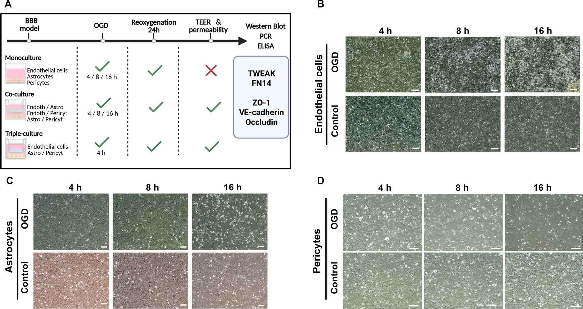 In Vitro Analysis of TWEAK/Fn14 Axis in the Blood–Brain Barrier Models during Oxygen–Glucose Deprivation and Reoxygenation
