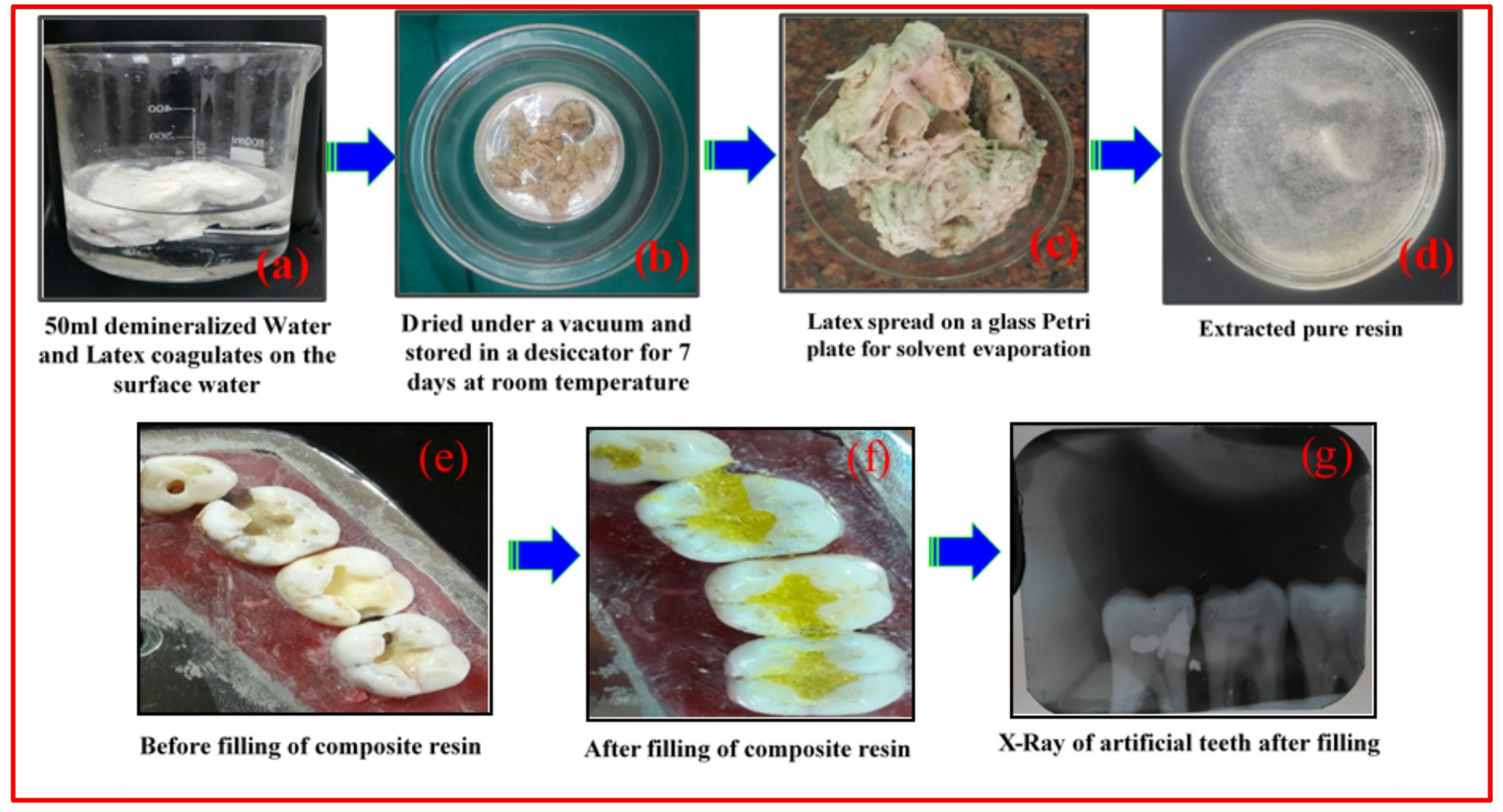 Novel Extraction Method of BIS-GMA Resin Free Latex from  (Jackfruit) and its Biomedical Applications
