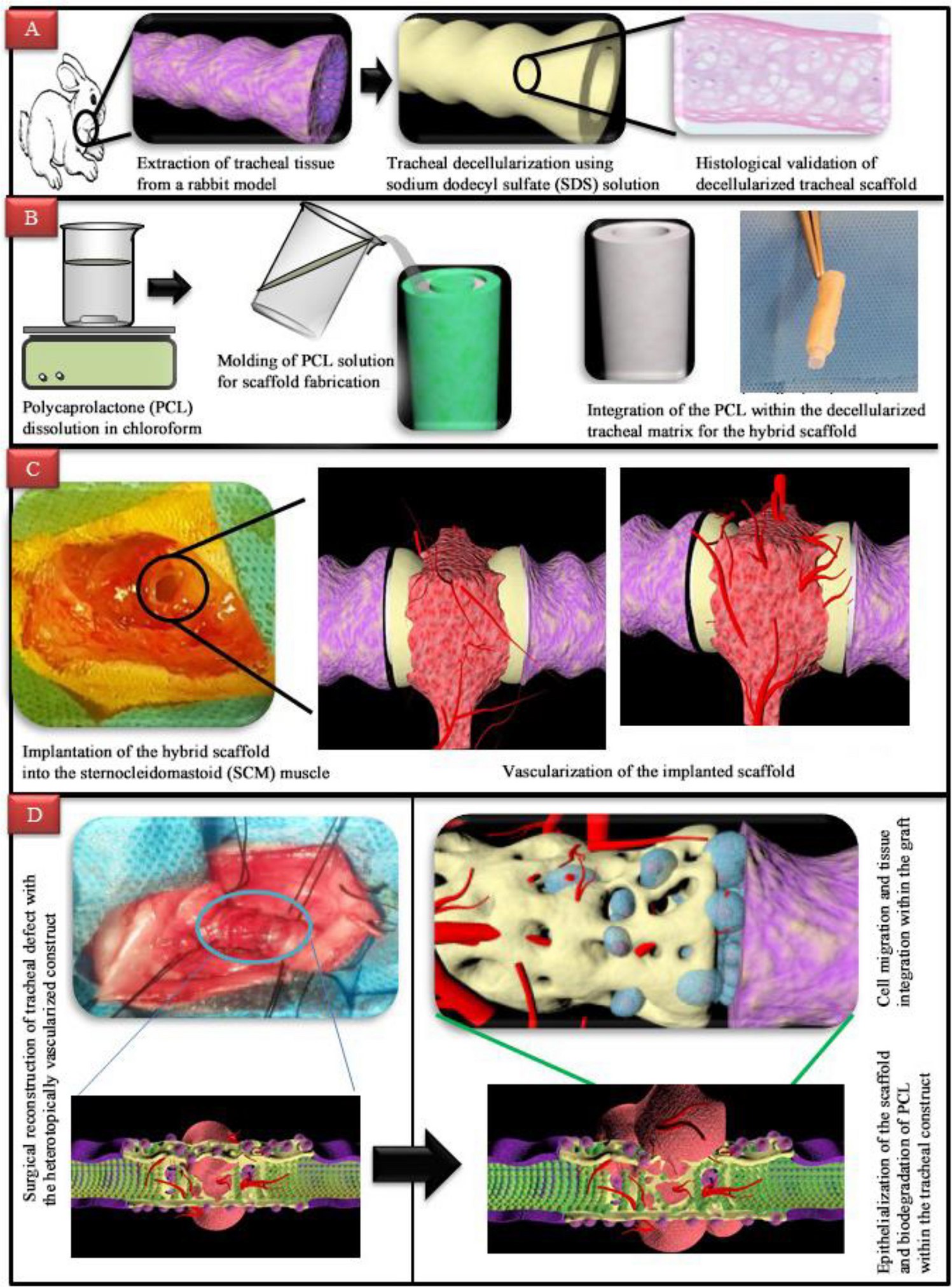 Tracheal Reconstruction Using Hybrid Decellularized-PCL Scaffolds: Two-Stage Heterotopic and Orthotopic Transplantation
