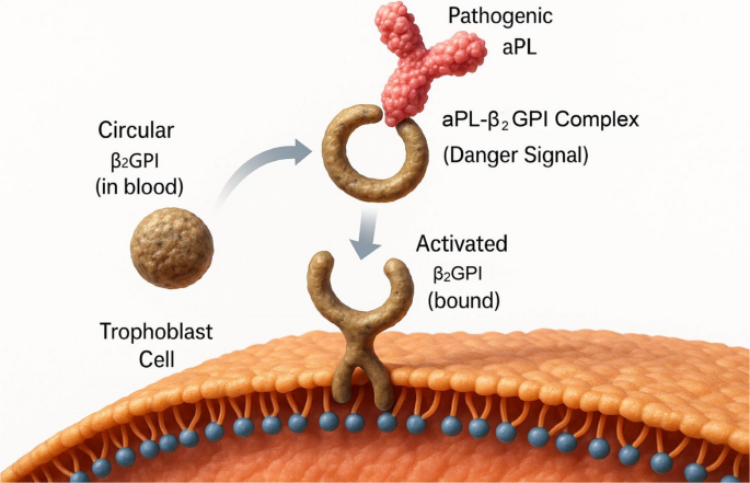 The Self-amplifying Inflammatory Cascade in Obstetric Antiphospholipid Syndrome: From Pathophysiology to Placenta-centric Immunotherapeutic Targets