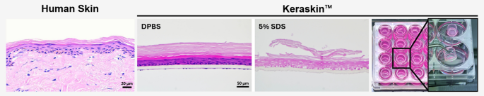 Development of in vitro skin corrosion test using KeraSkin™