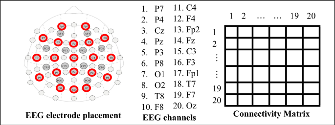 Reliable resting-state EEG connectivity measures reveal brain network destabilization and cognitive decoupling following prolonged extreme working conditions
