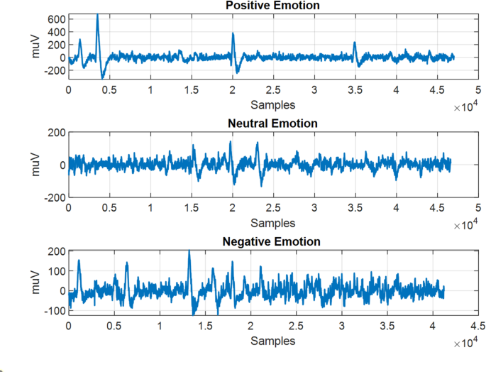Study of sequential emotional dynamics: a LSDVG approach with reduced electrode configuration