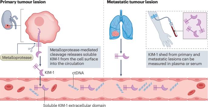 Current evidence and future directions for KIM-1 as a blood-based biomarker in RCC