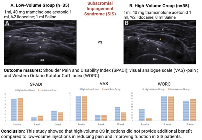 Effectiveness of High-Volume Corticosteroid Injection Diluted with Saline in Subacromial Impingement Syndrome: A Randomized Trial