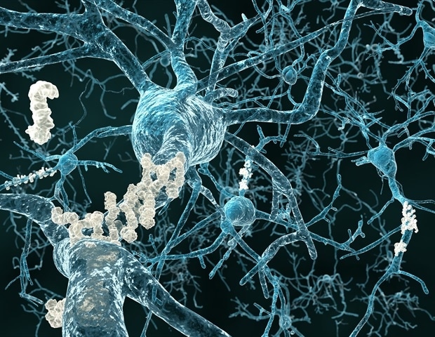 Researchers uncover new clues about the origin of Alzheimer's tau tangles