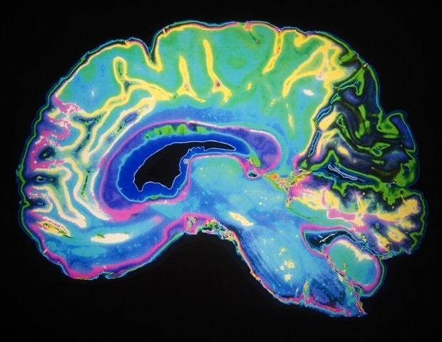 Gladstone scientists track exact routes used to clear brain waste