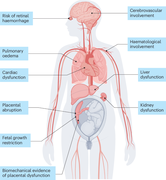 The pathophysiology of pre-eclampsia