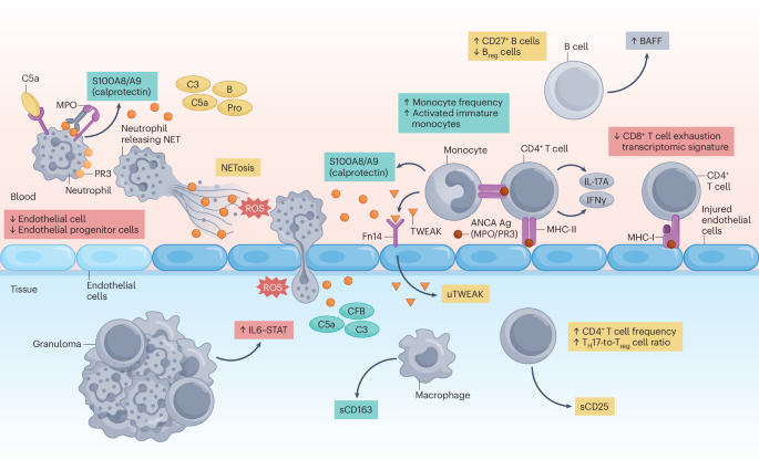 Anti-neutrophil cytoplasmic antibody-associated vasculitis: biological insights and biomarker-guided disease management