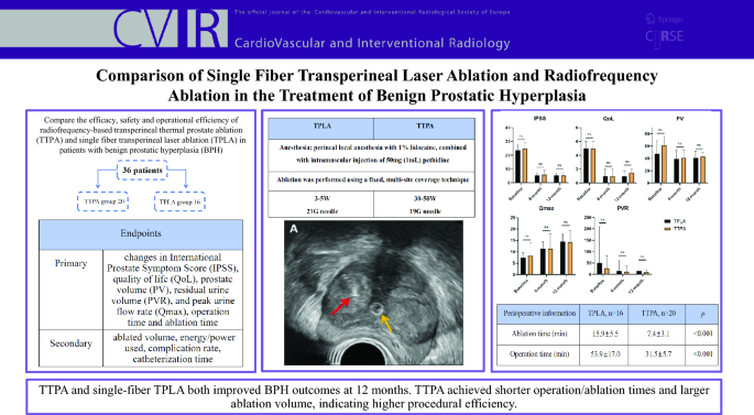 Comparison of Single Fiber Transperineal Laser Ablation and Radiofrequency Ablation in the Treatment of Benign Prostatic Hyperplasia